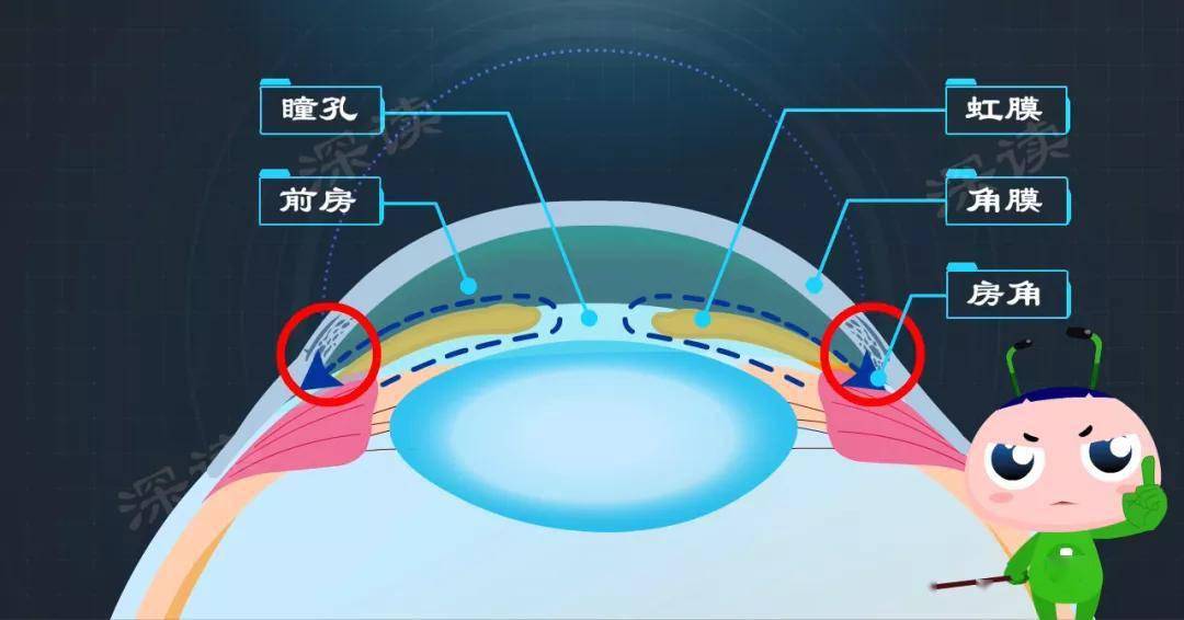 這些小事搞出青光眼_虹膜_睫狀體_瞳孔