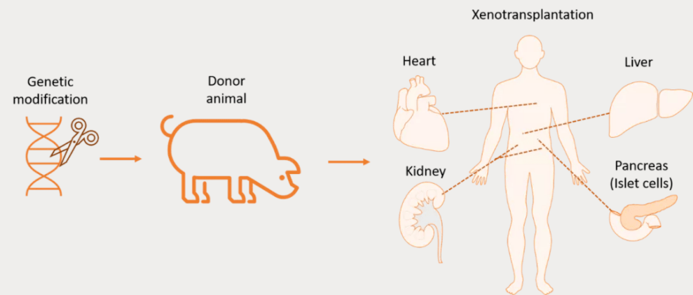 全球首例转基因猪心脏移植手术获阶段性成功57岁患者即将脱离机器生活