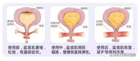 8cf17c43551b49f78d972693bd73f1c6.png