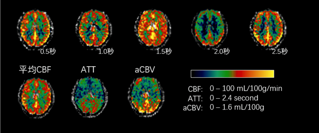 学术动态北京自然基金课题高分辨率多延迟asl脑血流成像及实时后处理
