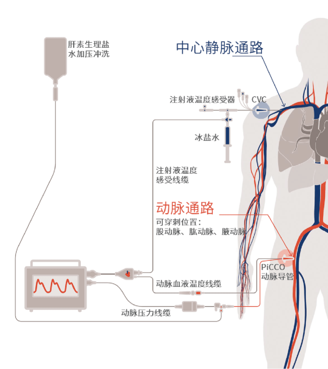 picco连接图片图片