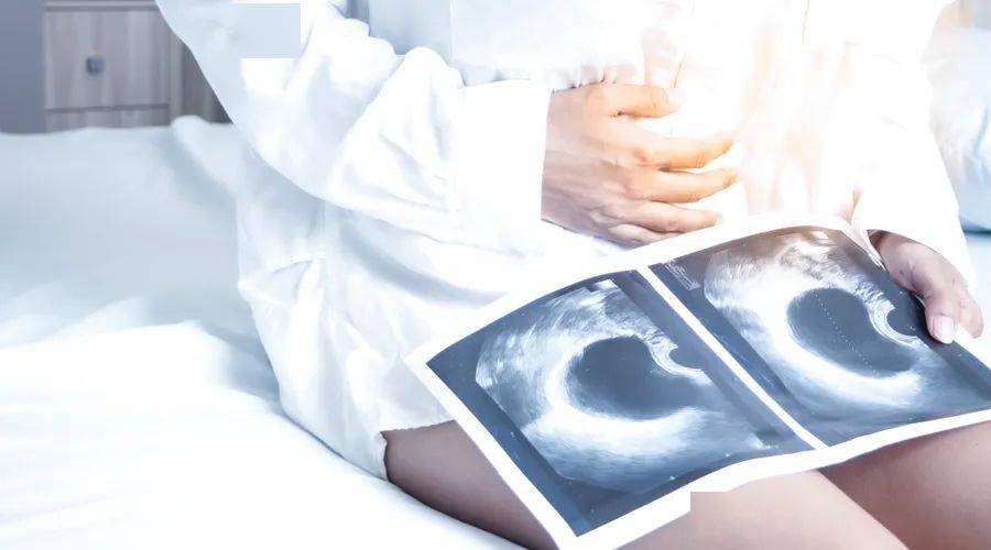 什么时候检查卵巢囊肿最好 0ca27fd8140e42cf8adc6a3e21c6fc04.jpeg