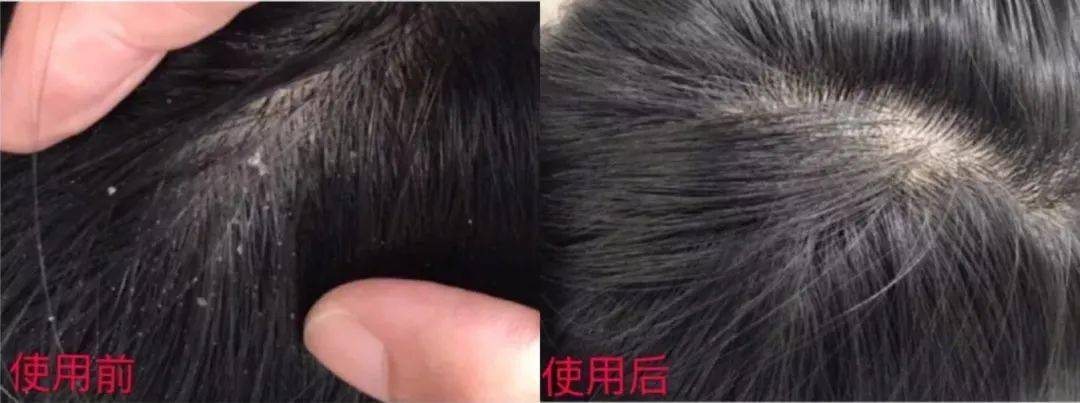 洗头“你的头发影响了你80%的颜值”：康王创始人87岁再出山，挑战5天不洗头！