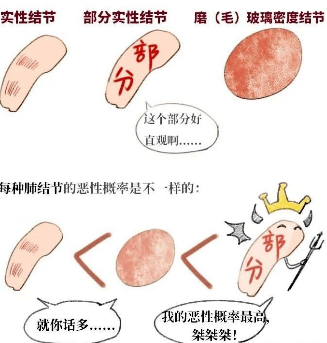 結節息肉囊腫增生等哪個才是癌症的先兆