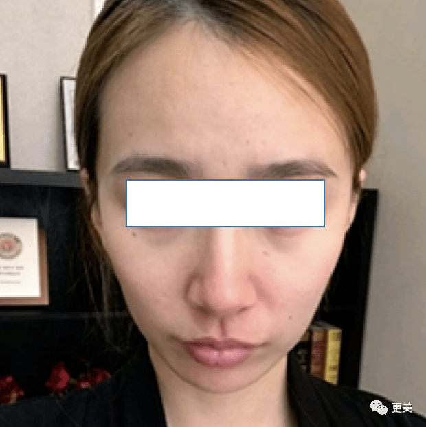 无辜为啥生娃5年的奶茶妹妹比热巴还嫩？