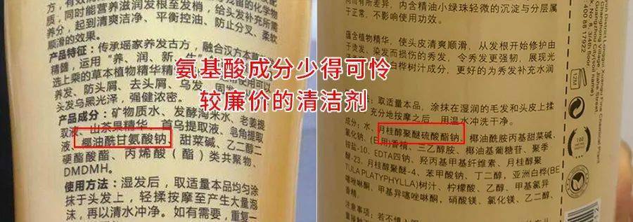 尸体头上抠下来的白泥竟是螨虫尸体!头痒头屑出油多,用它就对了
