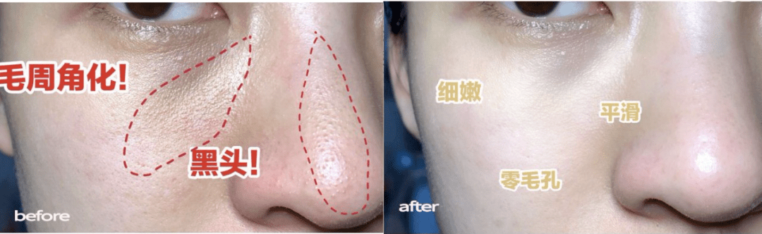 蜂巢不用洗面奶也可以把脸洗干净!用它也能搞定脸上的脏东西