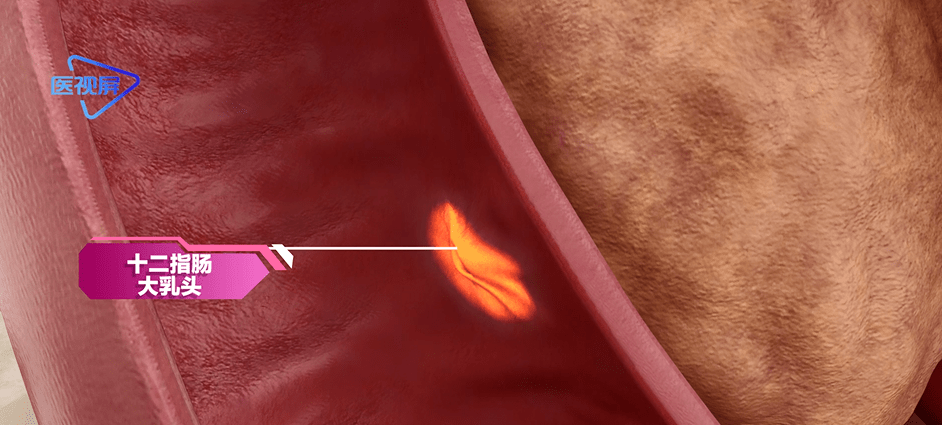 黏膜形成发达的环状襞,其后内侧壁上有一纵行的皱襞,叫做十二指肠纵襞