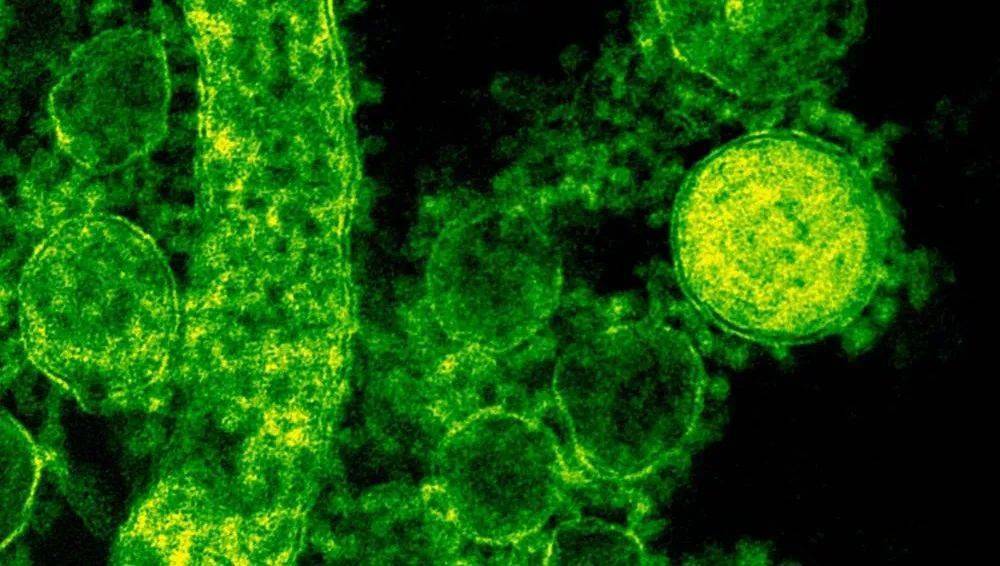 喷头|?蜂胶喷剂 呵护口腔健康