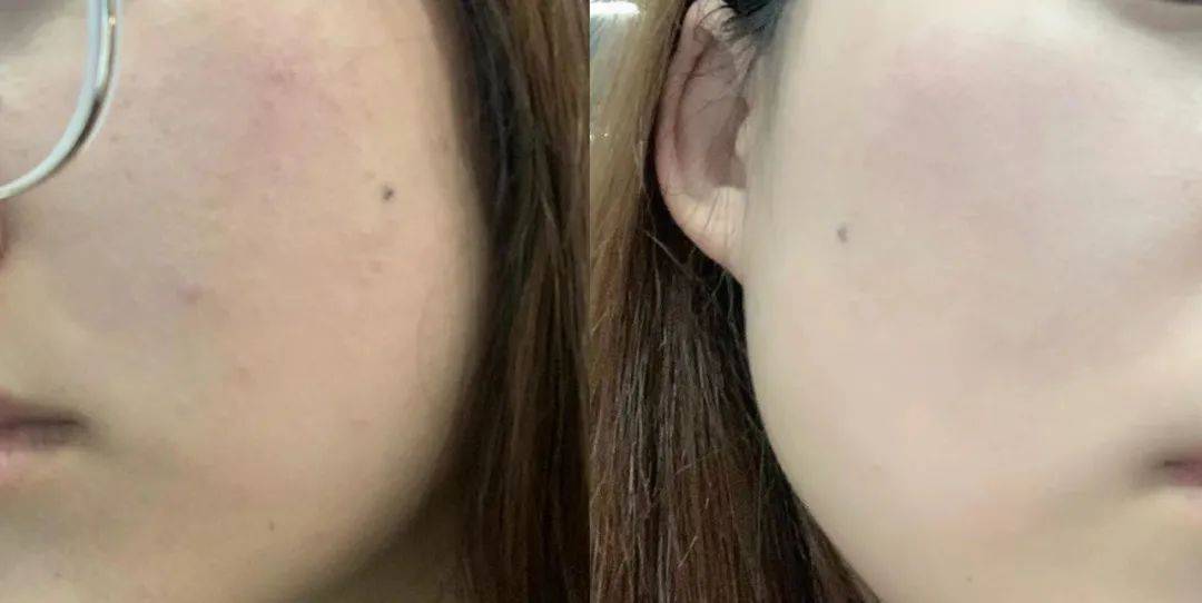 投资海蓝之谜正品5折价抢疯！补水、淡纹、修护，让你重回婴儿肌