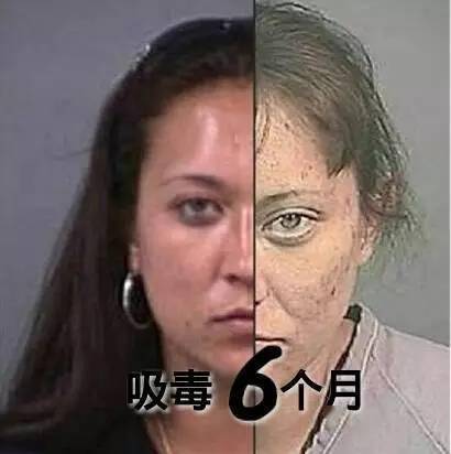 吸毒者面容的变化令人震惊,珍爱生命,远离毒品