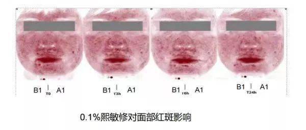 原料20块钱一公斤？护肤品成本这么低？？