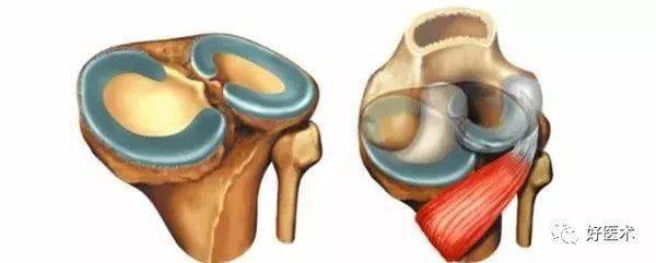 56張高清圖,牢記半月板解剖!_脛骨_膝關節_韌帶