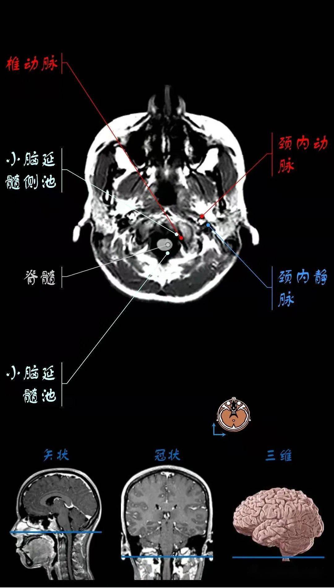 顱腦mri超詳細三維標註(最新版)_全網_影像_解剖圖