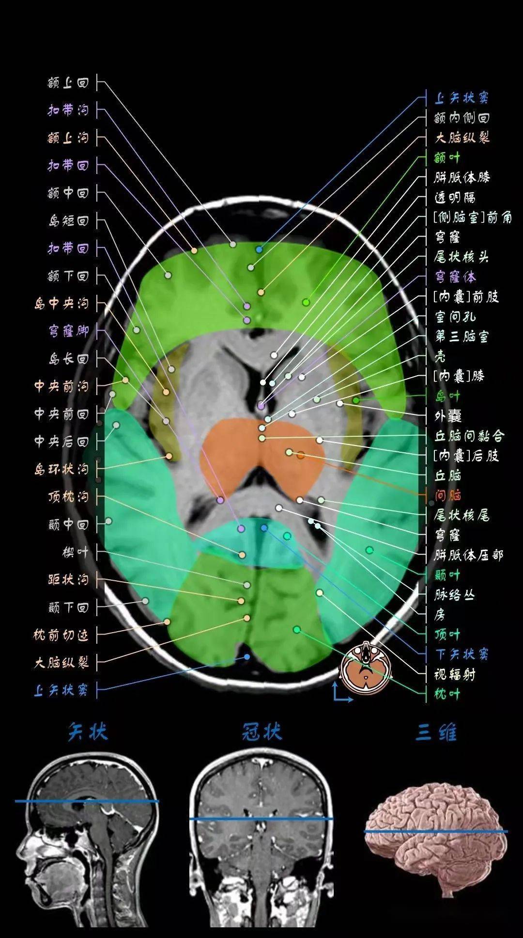 颅脑mri超详细三维标注(最新版)