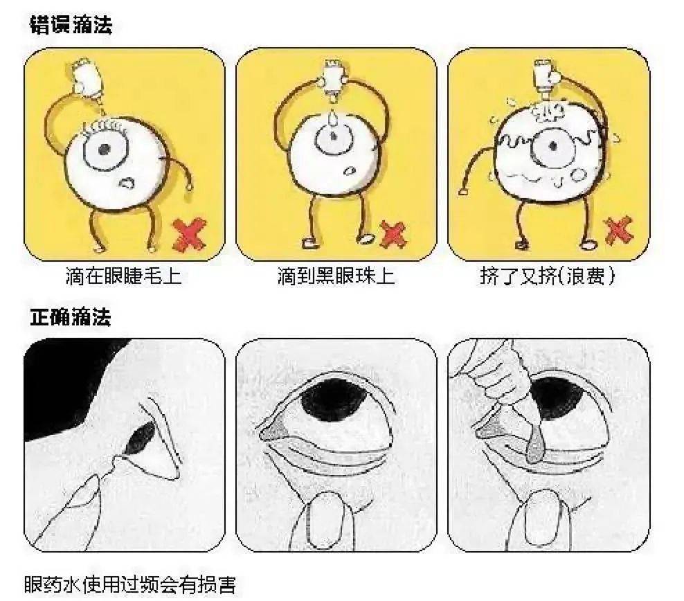 眼干眼涩眼疲劳第一类医疗器械认证1s出雾眼睛终于不累了