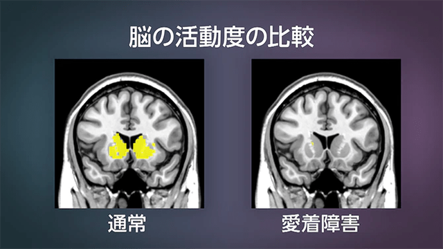 脑科学研究成果证实,这些育儿方式会损害孩子的大脑