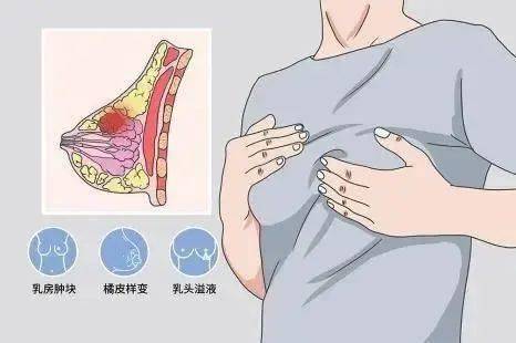 乳房有肿块,乳头溢液,明显疼痛这些情况需要做乳腺超声检查