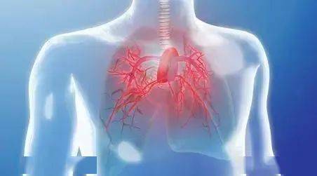 女士|我院肺动脉高压手术登上国际舞台！29岁的女士称“正常呼吸真好”