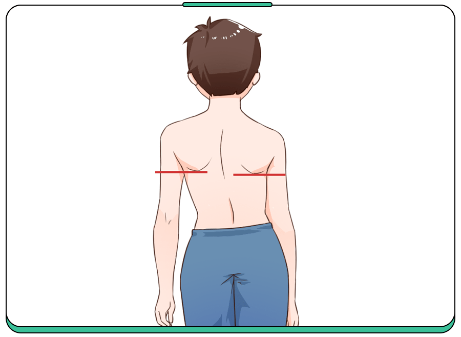 观察肩胛骨是否有一边突出图片来源 科学家庭育儿原创1