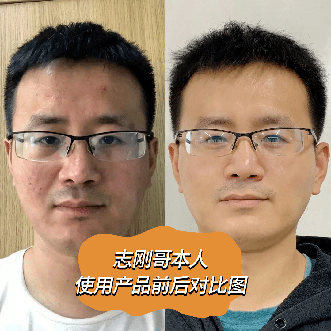 护肤品早晨不要着急洗脸，涂点精华，这样六十岁都肌肤如水！