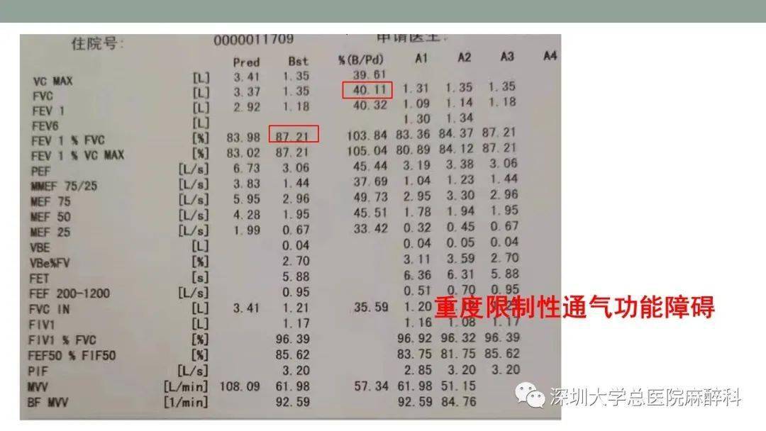 肺功能检查解读实用