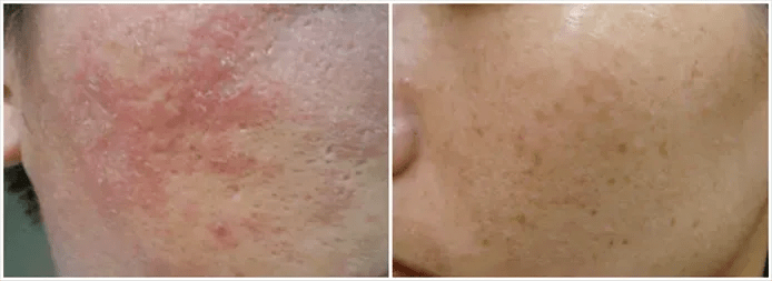 品牌防晒“金钟罩”非TA莫属!火爆西班牙47年,轻薄似水,0酒精0负担!