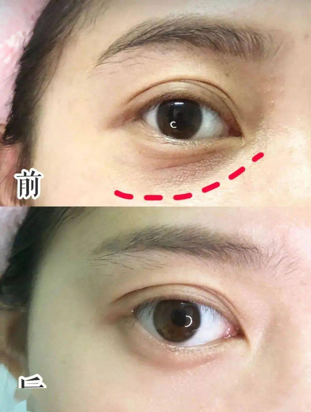 内部测试她眼睛怎么这样？娜B才20岁啊，这也太冤了吧…