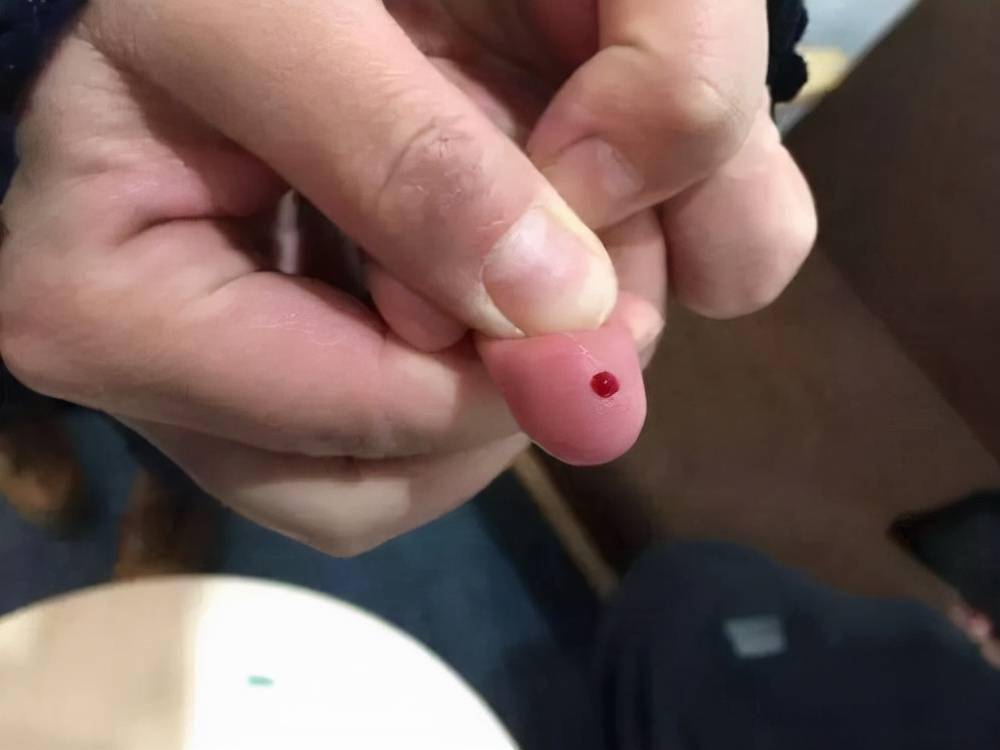 测血糖扎哪根手指才准确医生多数人扎错了或等于白测