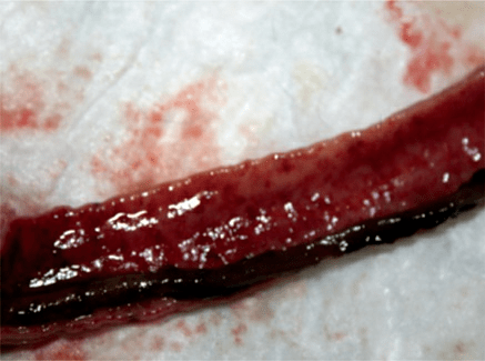 猫瘟有几类临床症状猫瘟病原体病理机制与临床症状