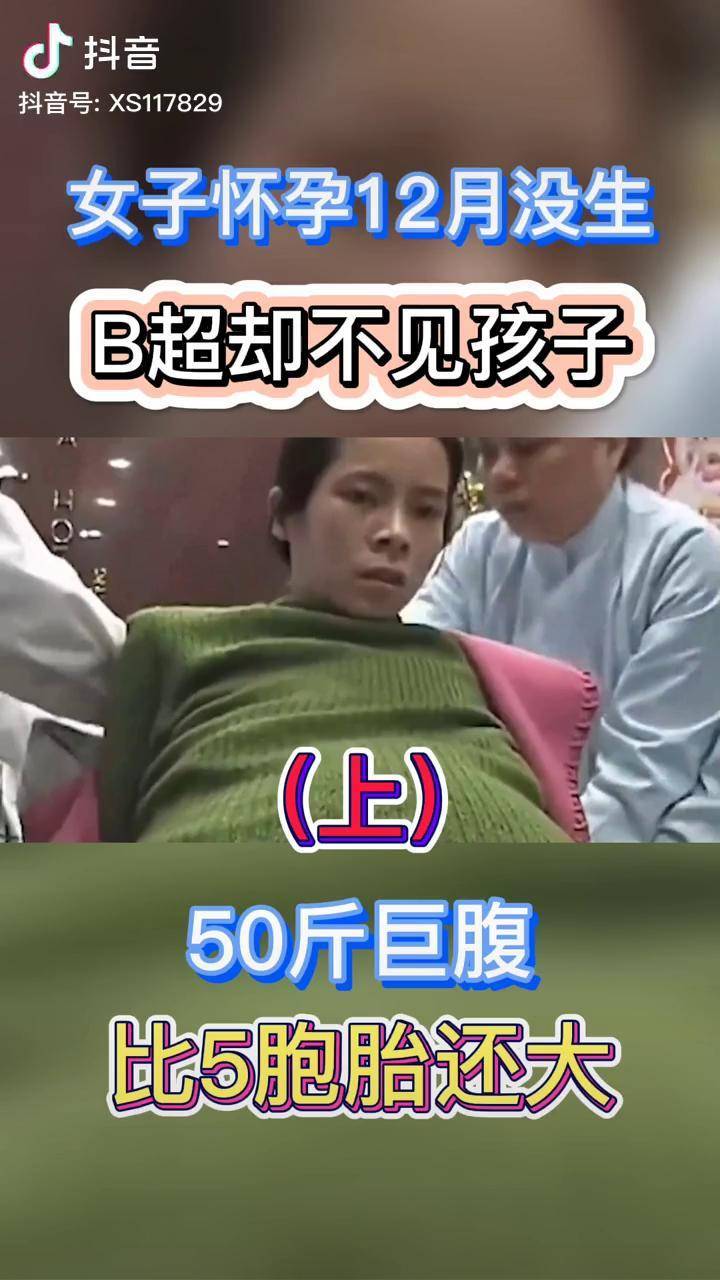 广东女子怀胎12月未生b超却照不见孩子医生直呼难以置信历史我的厨房