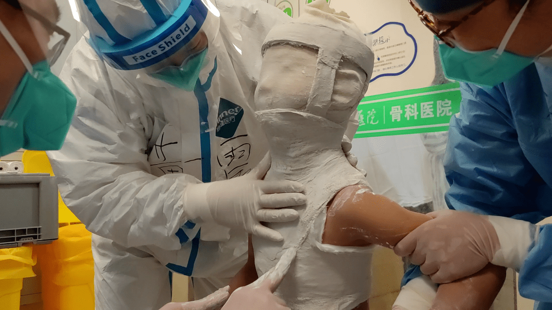 隔离服|7岁女童寰枢关节脱位，上海长征医院技师进风险区为她打石膏