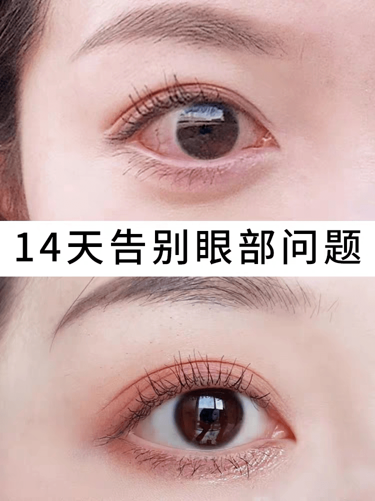 b2e24ad1446f4df7b13d2c69b0771e19.png