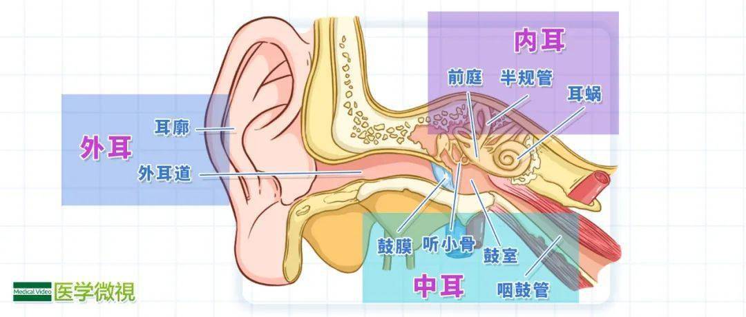 耳朵总是嗡嗡响,伴有疼痛,警惕这种可致聋的疾病