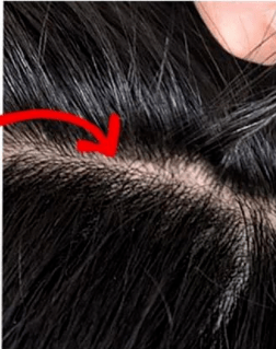 洗头头皮油脂“清道夫”!千年盐湖盐泥+北极光云杉,3天不洗头不油也不痒,头发像丝绸一样顺滑!