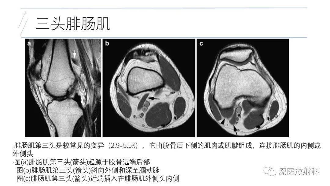 2021年中国磁共振行业成绩公布·点击阅读原文,挑选影像书籍!