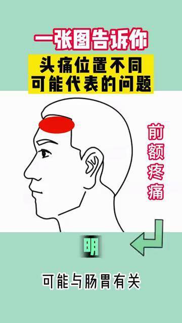 干货来了一张图告诉你不同头痛位置可能代表的身问题头痛