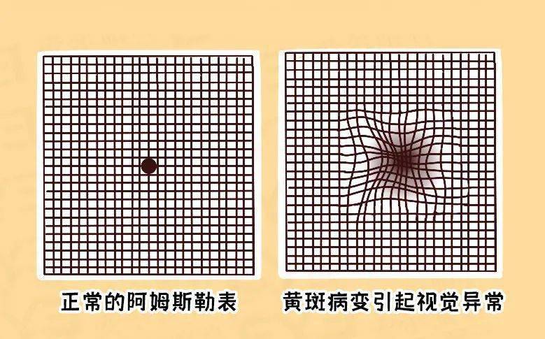 生理盲点图图片