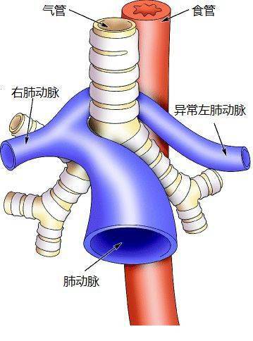 支气管动脉位置图片
