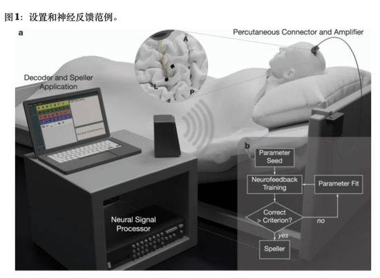 交流|技术获突破，脑机接口将成下一代元宇宙入口，行业复合增速超12%