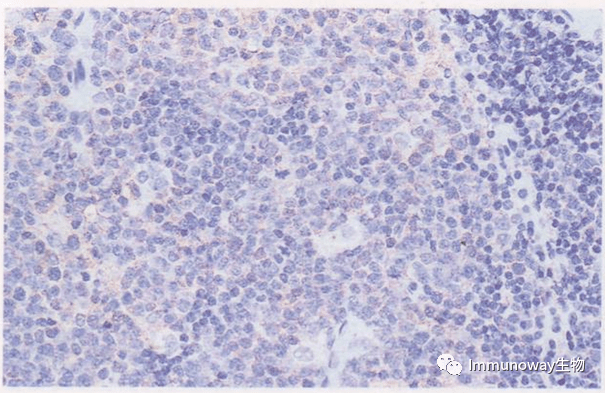 免疫组化(ihc)│常见问题及解析集锦_组织_染色_抗原