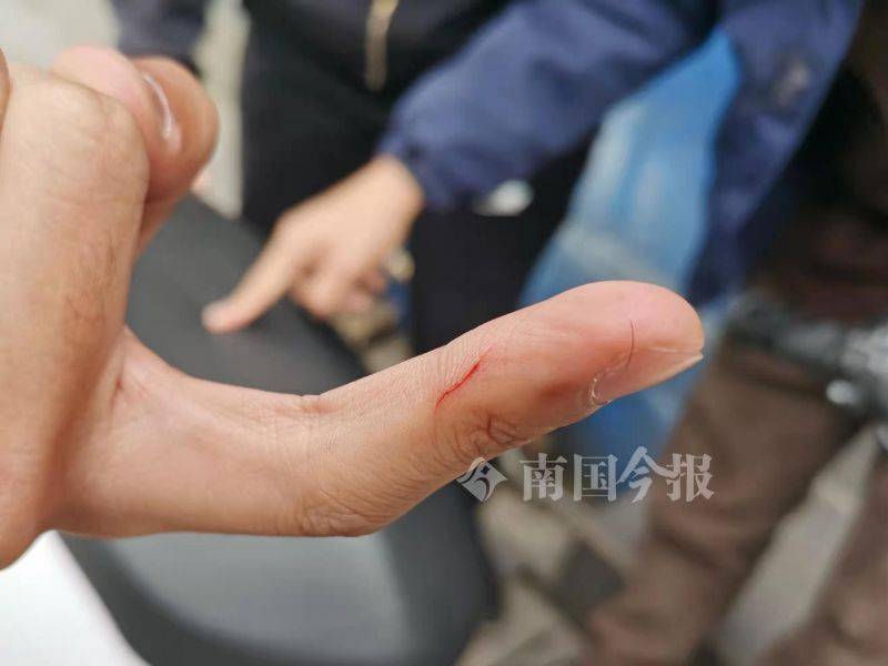 电动车座包竟暗藏针头柳州一名少年被划伤父母担心针头有病菌