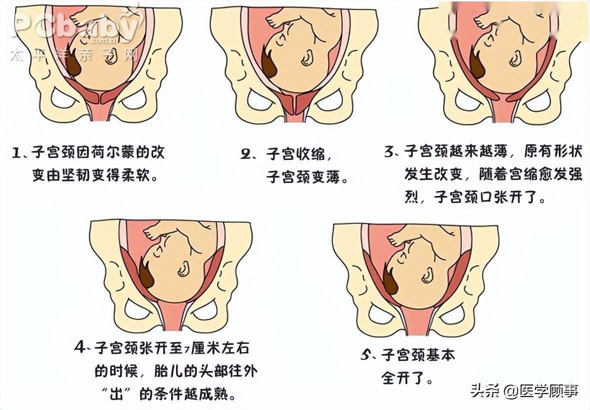 产道是指哪个部位图片