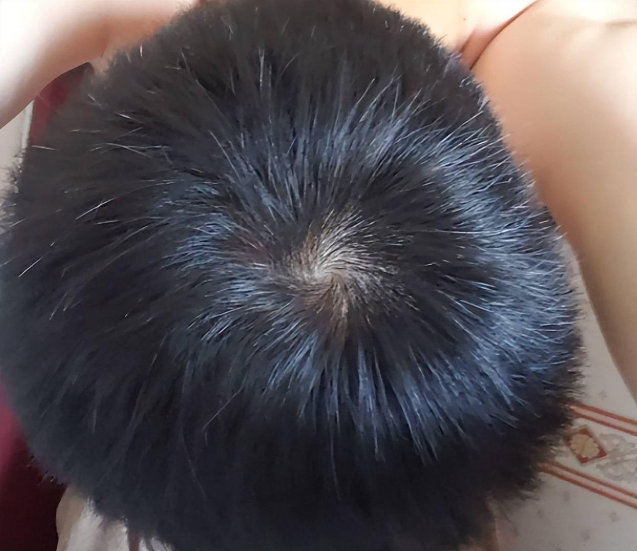会慢慢转化成比较粗黑的体毛,就是头发,等到出生的时候,头顶上的旋便