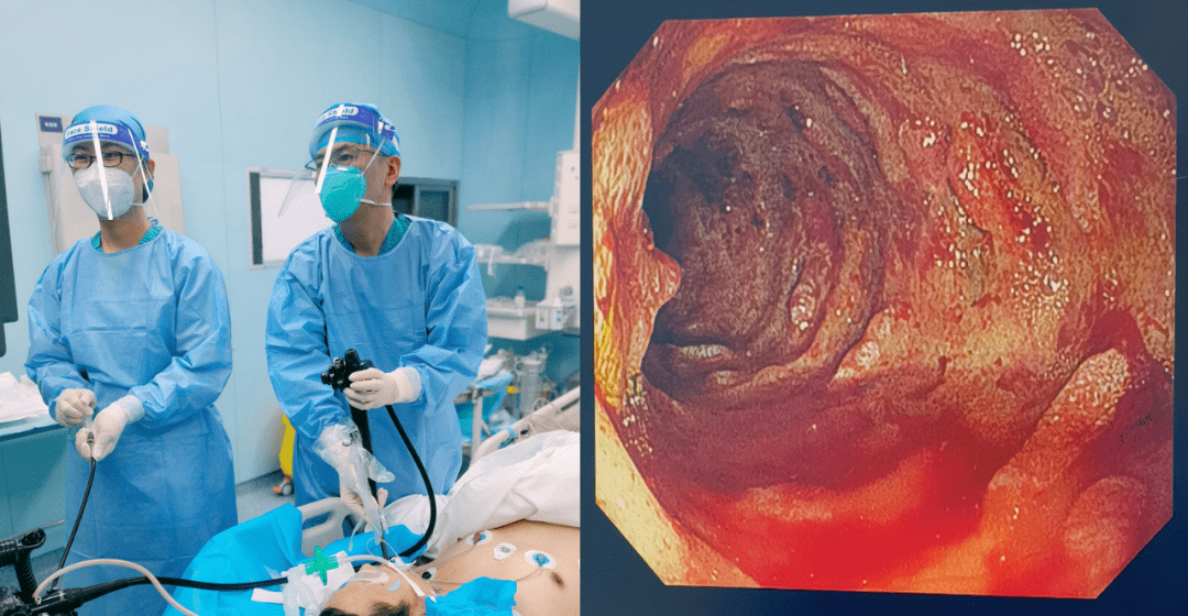 守胃健康镜待春来胃肠内科内镜中心抗疫纪实