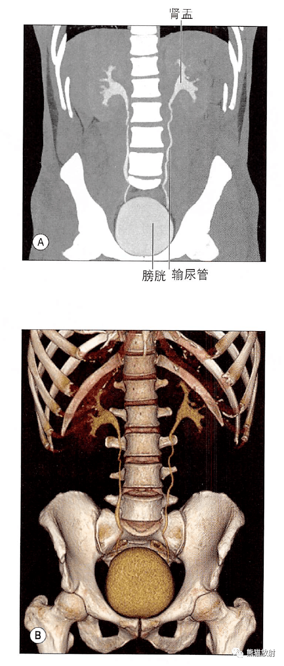 解剖丨脾肾上腺泌尿生殖发育肾和输尿管