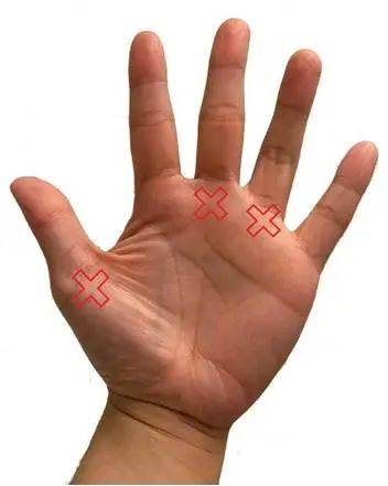 论"扳机指"的自我修养小m时尚·昨天 21:2240岁后,走路时"膝盖响",是