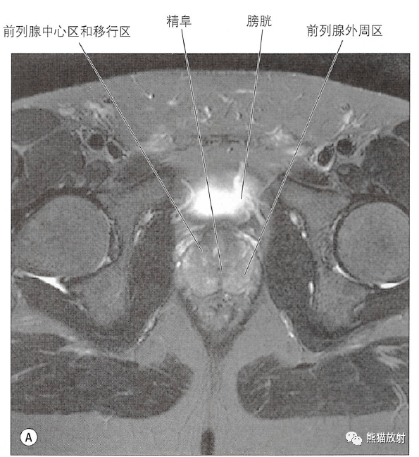 解剖丨膀胱前列腺尿道生殖系統