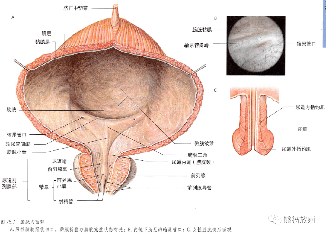 女性前列腺分泌图片