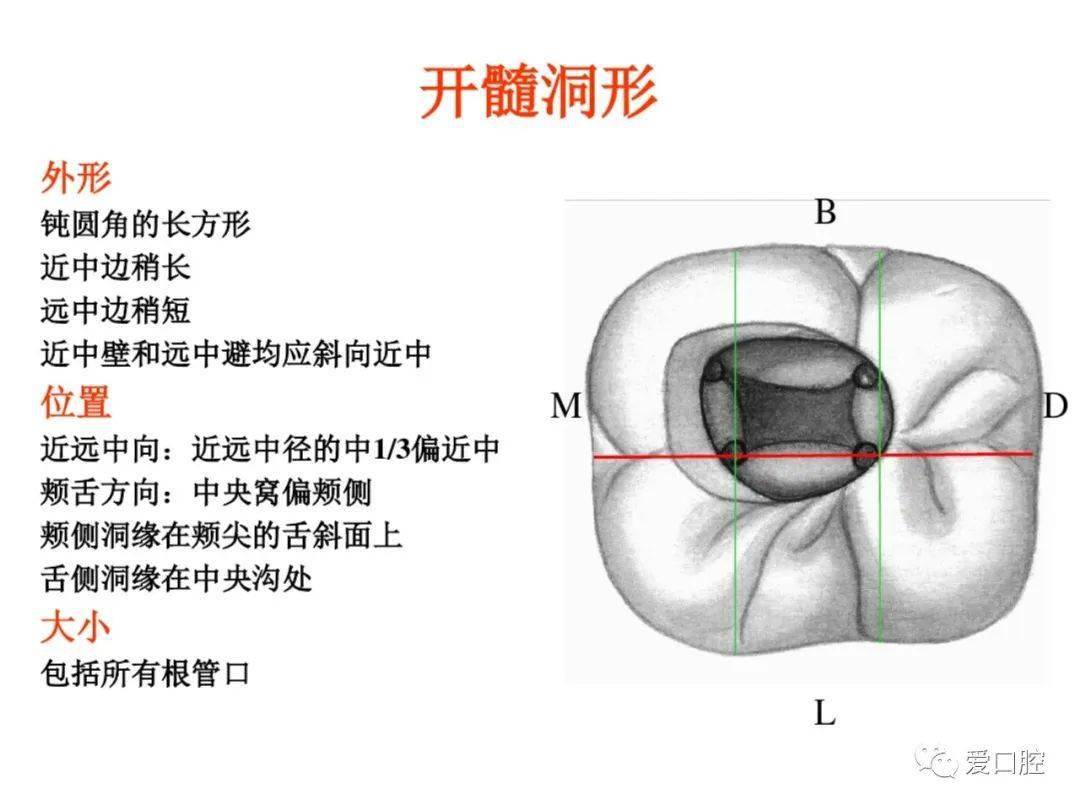 乳磨牙开髓部位图片